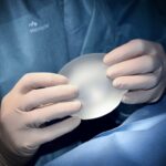 Cirugía de mamoplastia si vives en Perú: transforma tu figura con la ayuda de la Clínica Obesidad y Envejecimiento